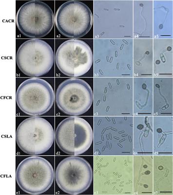 Colletotrichum Spp. Diversity Between Leaf Anthracnose and Crown Rot From the Same Strawberry Plant